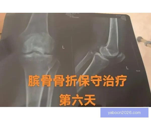 穆迪左膝髌腱撕裂赛季提前报销复出前景堪忧康复之路漫长挑战重重